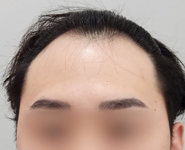 Before