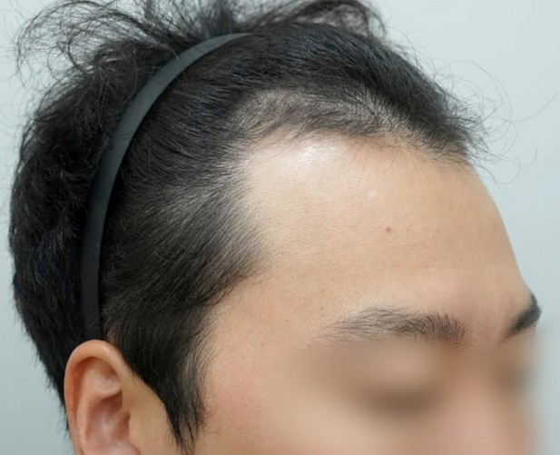 Before