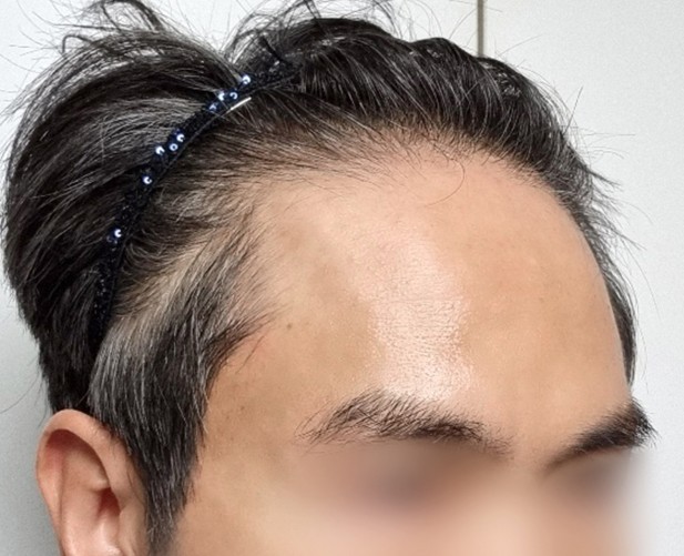 Before