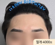After