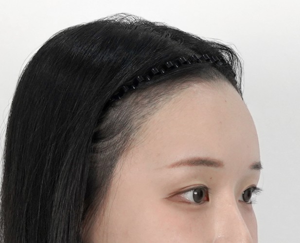 Before